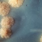 Mycobacterium tuberculosis (Publiek Domein - wiki)