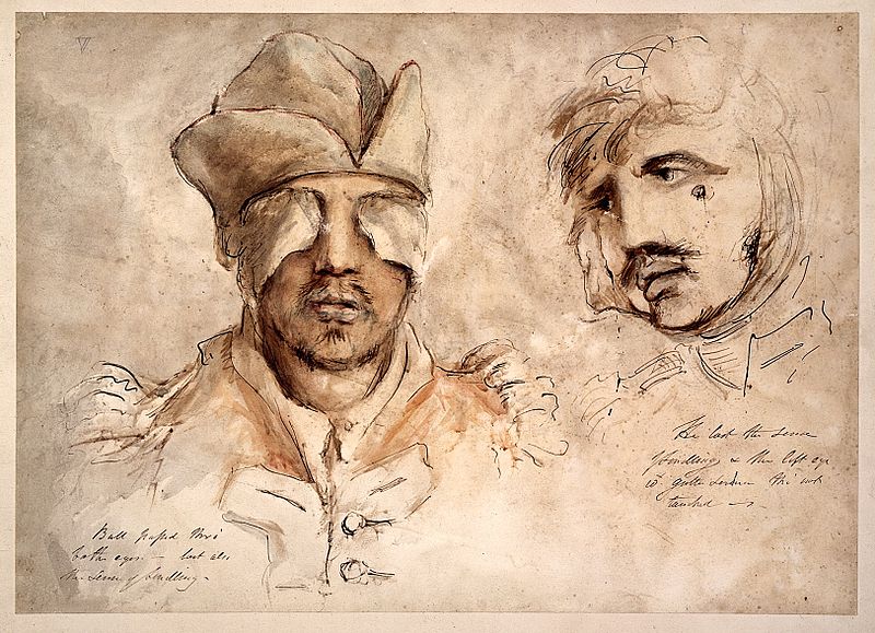Twee tekeningen van soldaten met oogwonden - Charles Bell