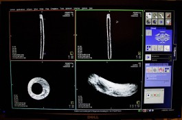 Middeleeuwse blokfluit door röntgen-scan