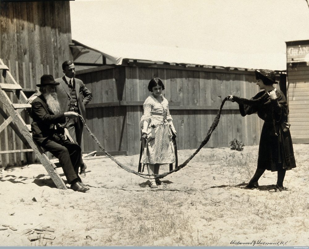 Een jong meisje is aan het touwtje springen met de baard van Hans Langseth, ca. 1920 - Wellcome Library, London. Wellcome Images, CC BY 4.0