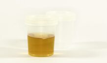 Urinebelasting – Belasting op het verhandelen van menselijke urine