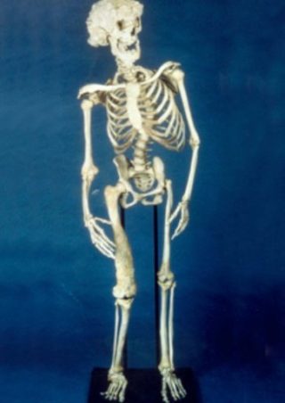 Skelet van Joseph Merrick (Wiki commons)