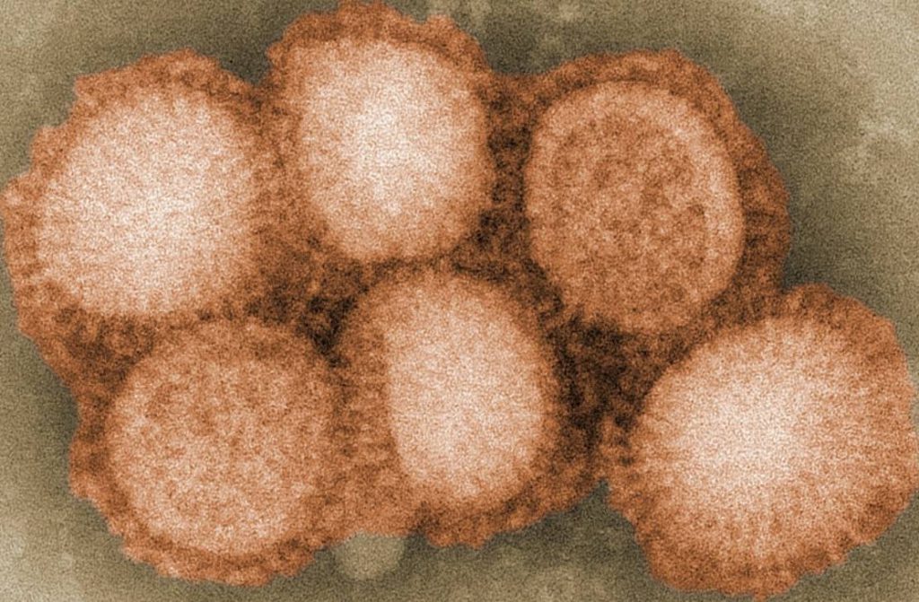 Spaanse Griep, ook wel het H1N1 virus, onder de microscoop