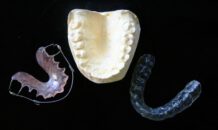 De beugel: een korte geschiedenis van de orthodontie