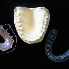 De beugel: een korte geschiedenis van de orthodontie