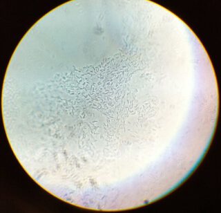 Clostridium acetobutylicum in duizendvoudige vergroting 