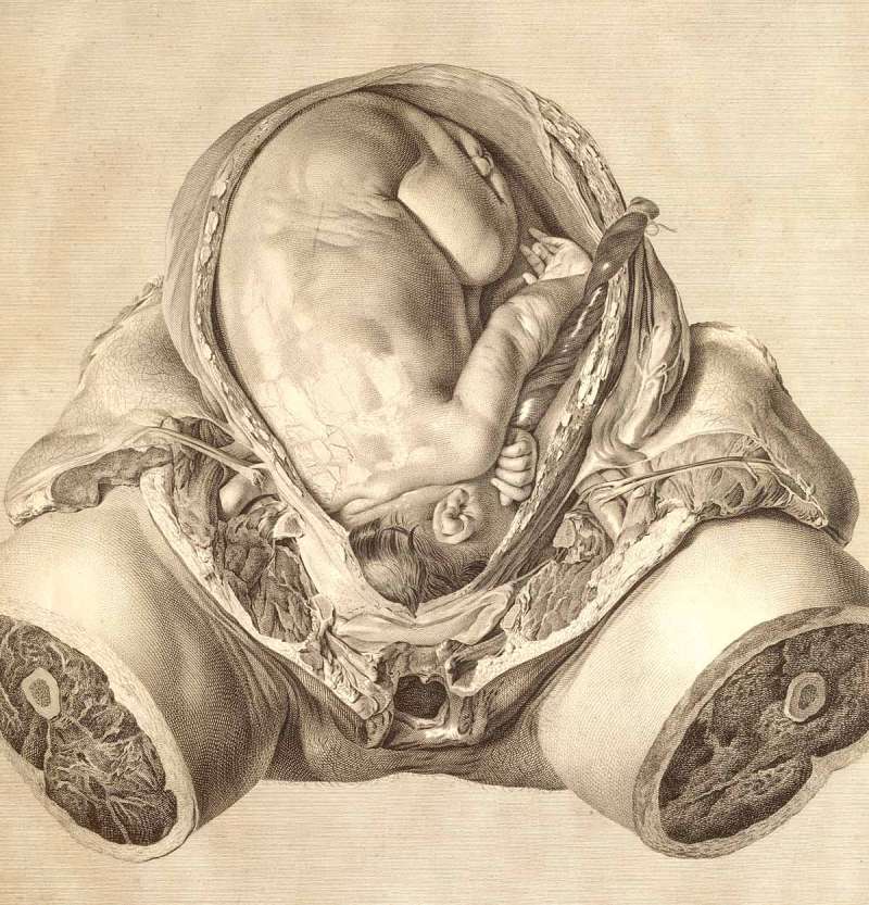 Verbeelding door Van Riemsdyk in Hunters boek The Anatomy of theGravid Uterus van 1774.