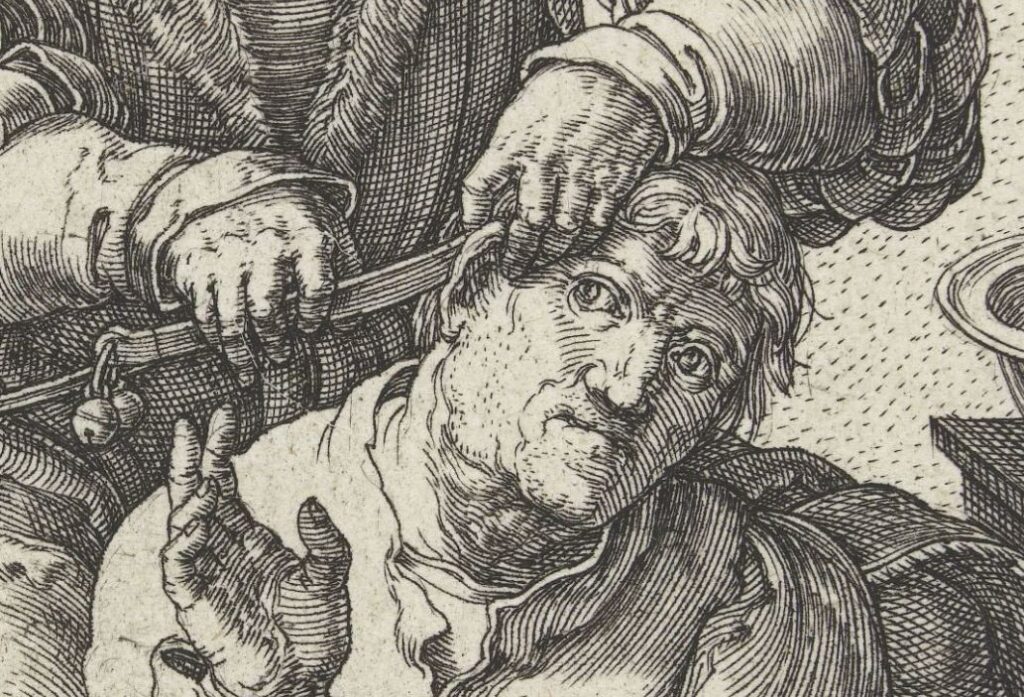 De chirurgijn, Lucas van Leyden, 1524 - detail