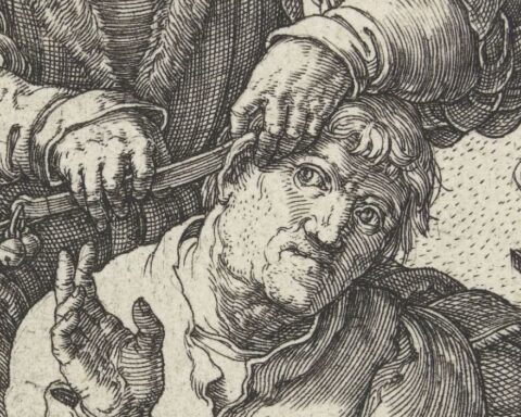 De chirurgijn, Lucas van Leyden, 1524 - detail