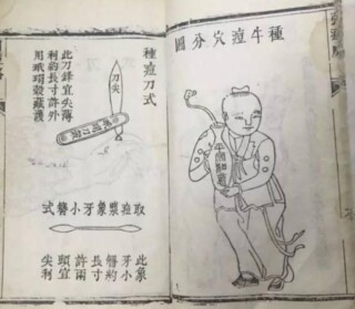 variolatie china