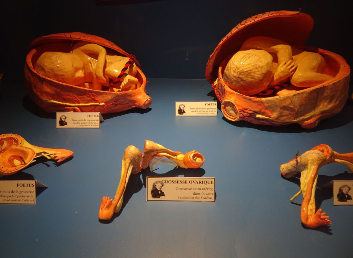  Auzoux en zijn anatomische modellen van papier-maché